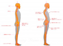 腰痛にもタイプがあるのはご存知ですか？