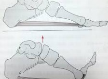 様々な症状に関係する足のウィンドラス機構