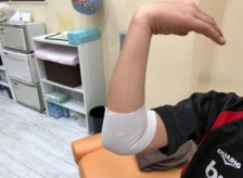 野球肘（外側型）上腕骨小頭離断性骨軟骨炎の少年の治療をしました。